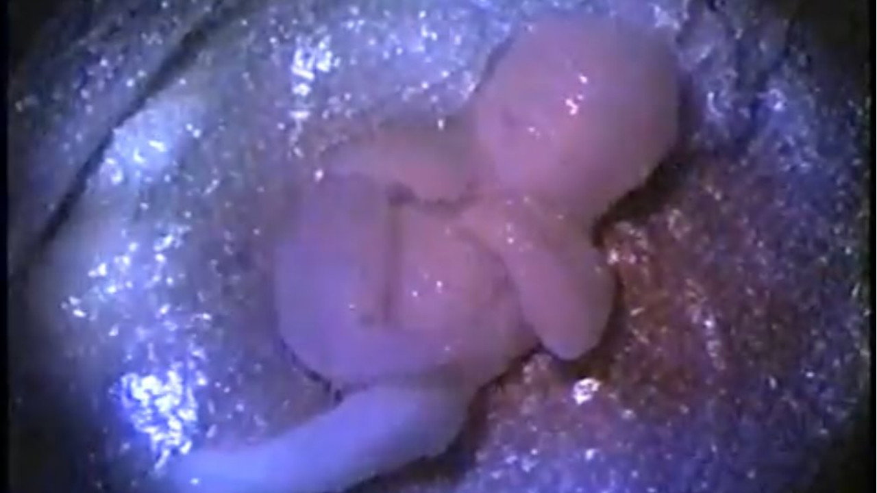 Backdrop